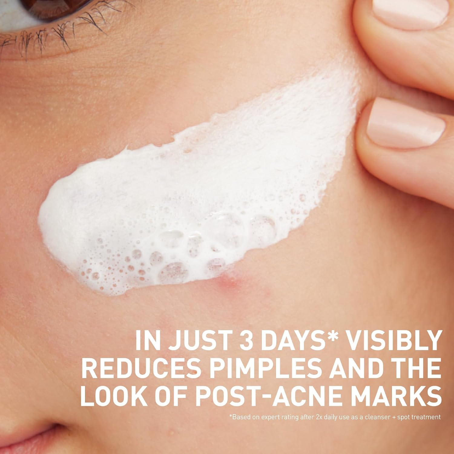 CeraVe Clay To Foam Acne Face Wash.Salicylic Acid & Kaolin Clay Acne Spot Treatment Clears Pimples & Blackheads. Prevents Breakouts. Hydrates & Soothes. Fragrance-Free. Non-Comedogenic.4oz.(Pack of 2)