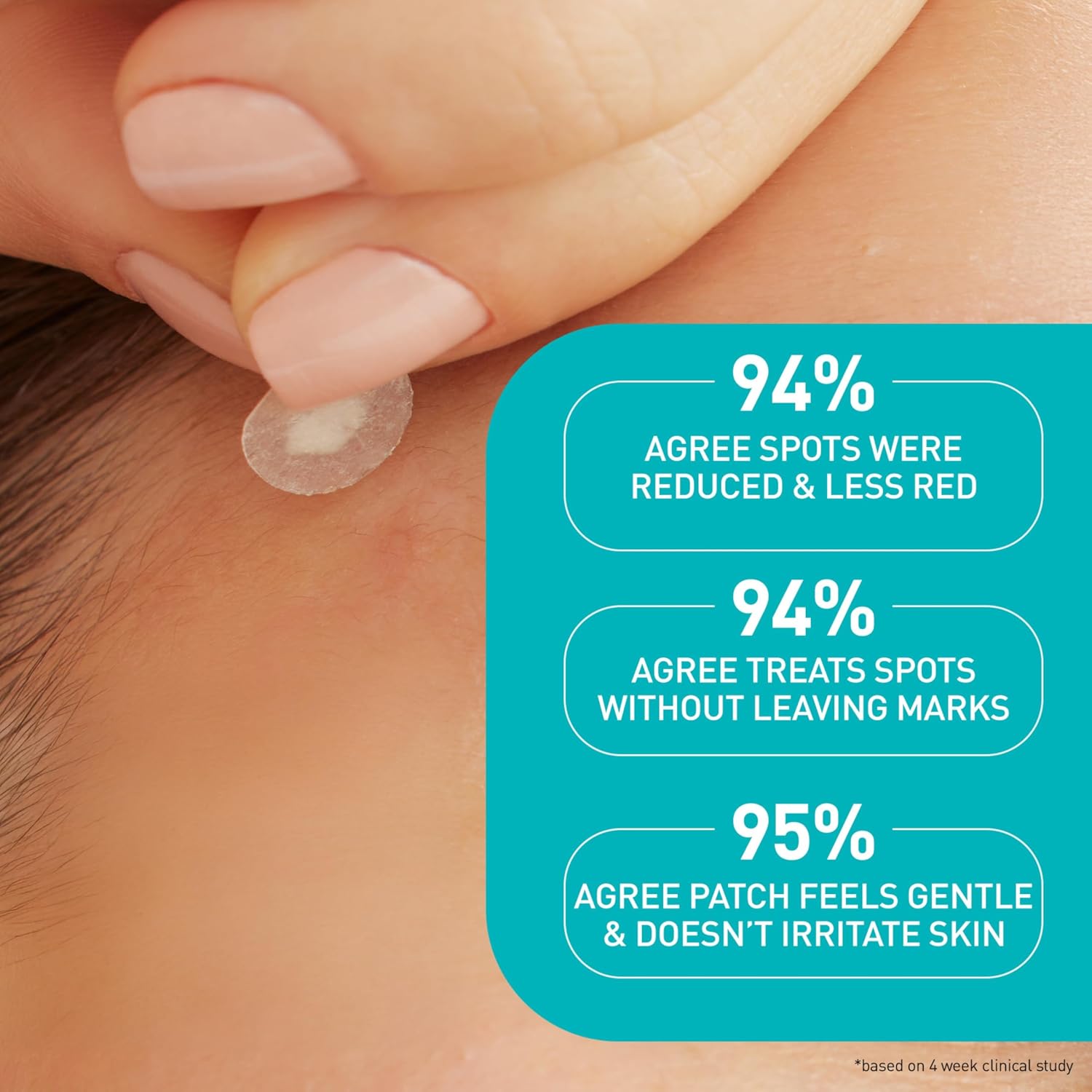 CeraVe Hydrocolloid Pimple Patches with Niacinamide. Ultra-Thin. 22ct | Absorbs Oil with Niacinamide and Ceramides. Ultra-Thin Acne Patches That Blend Into All Skin Tones. For Sensitive Skin