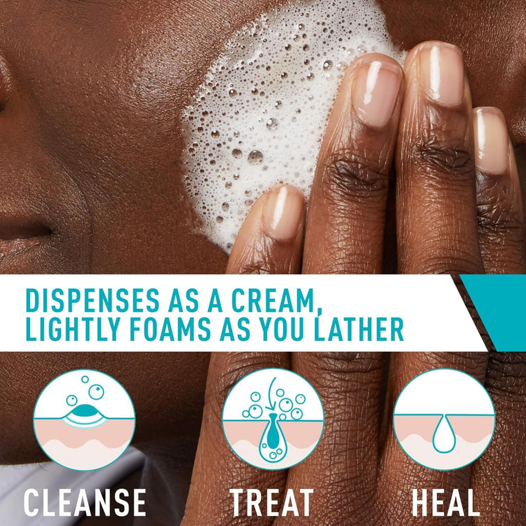 CeraVe Foaming Acne Cream Cleanser. Face Wash with 4% Benzoyl Peroxide. 5oz | Skin Care. Hyaluronic Acid. Niacinamide. Facial Cleanser. Acne Treatment For Face. Face Care. Gentle Cleanser. Ceramides