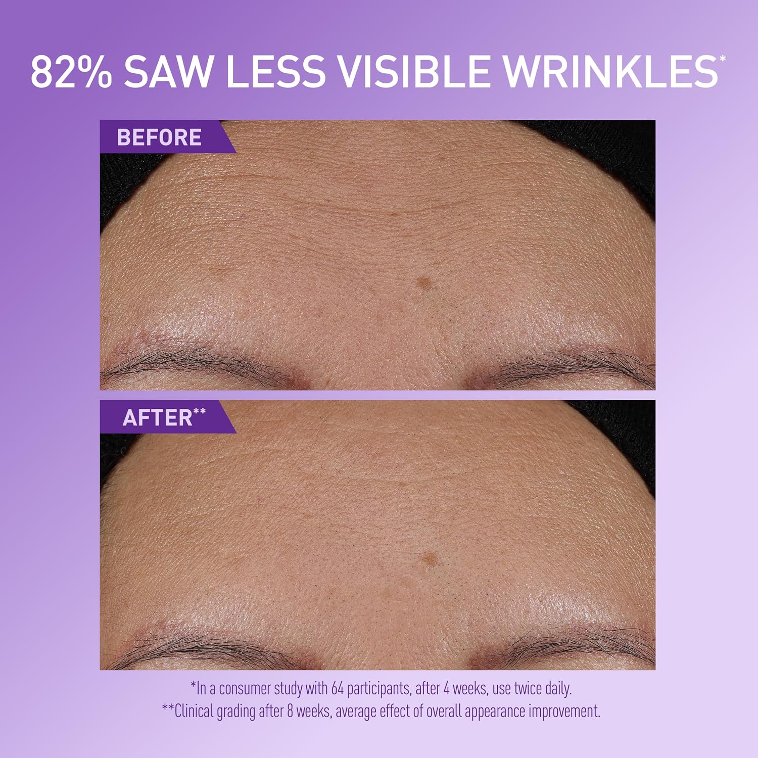 Super Boost Anti-Aging Serum with Peptides. Hyaluronic Acid & Ceramides | Face Serum with Ceramides. Peptides. Hyaluronic Acid. Vitamin B12 & LHA. Fine Lines & Wrinkles. Hydrating Milky Texture