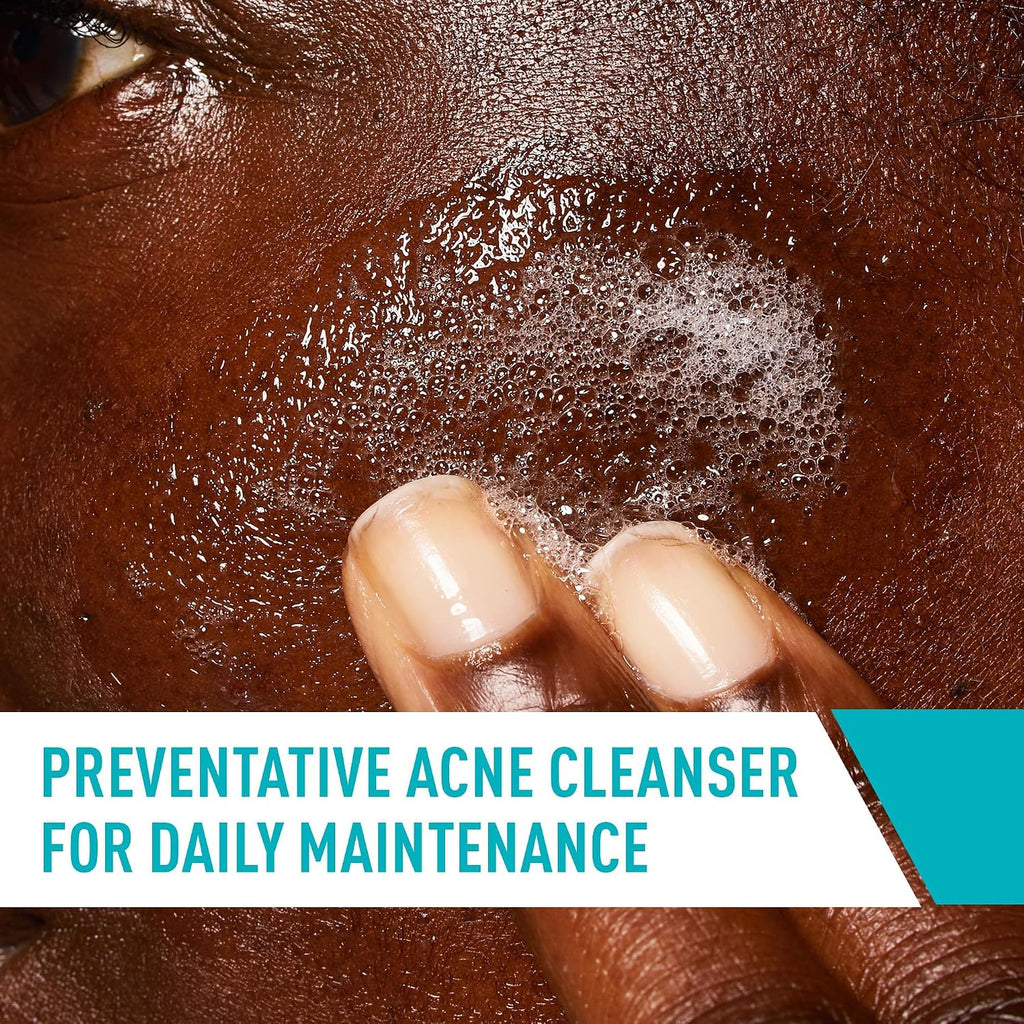 CeraVe Acne Control Cleanser. Face Wash with 2% Salicylic Acid. 8 oz | Skin Care with Niacinamide. Acne Face Wash. Acne Treatment For Face. Ceramides. Fragrance Free. Gentle. Oil Absorbing Clay