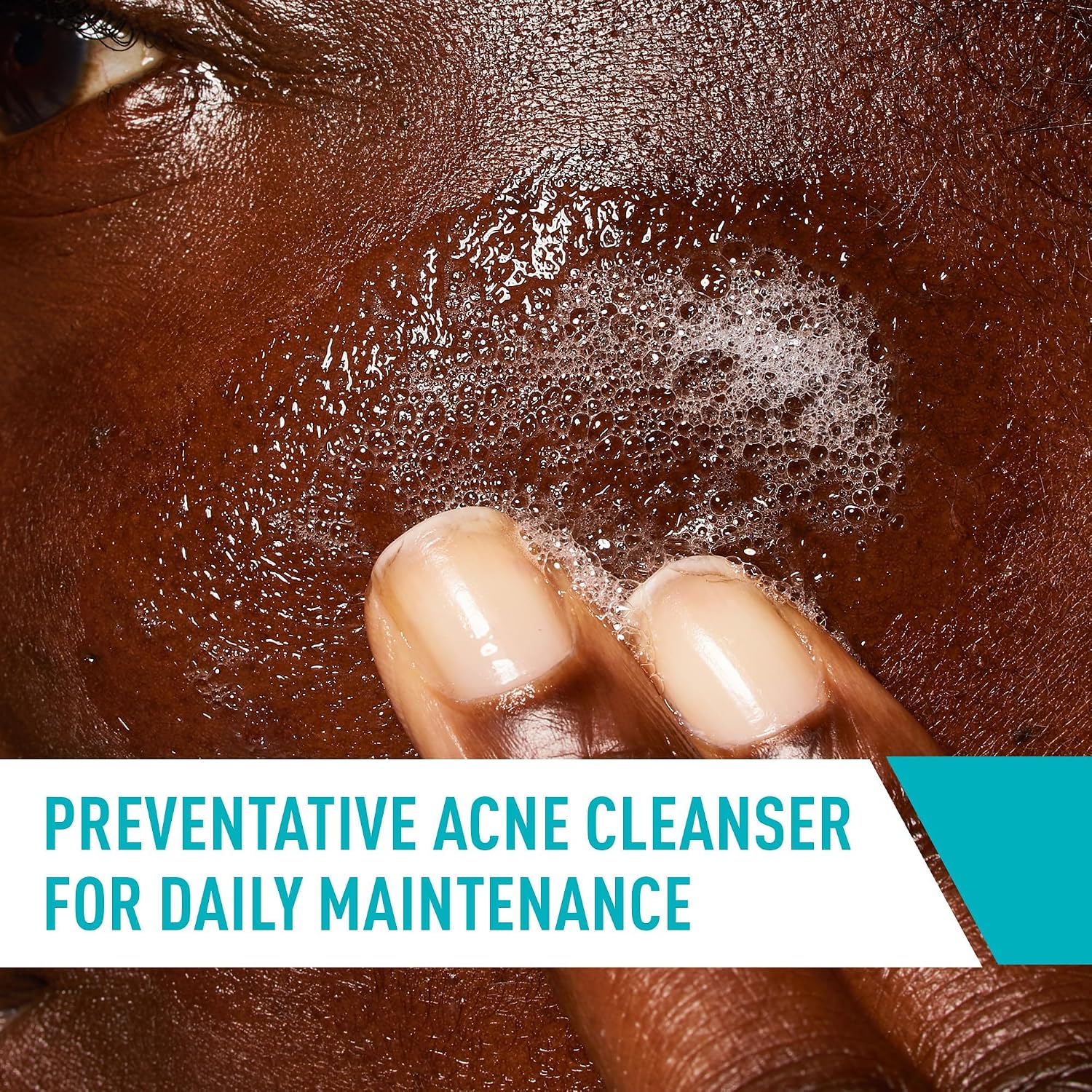 CeraVe Acne Control Cleanser. Face Wash with 2% Salicylic Acid. 8 oz | Skin Care with Niacinamide. Acne Face Wash. Acne Treatment For Face. Ceramides. Fragrance Free. Gentle. Oil Absorbing Clay