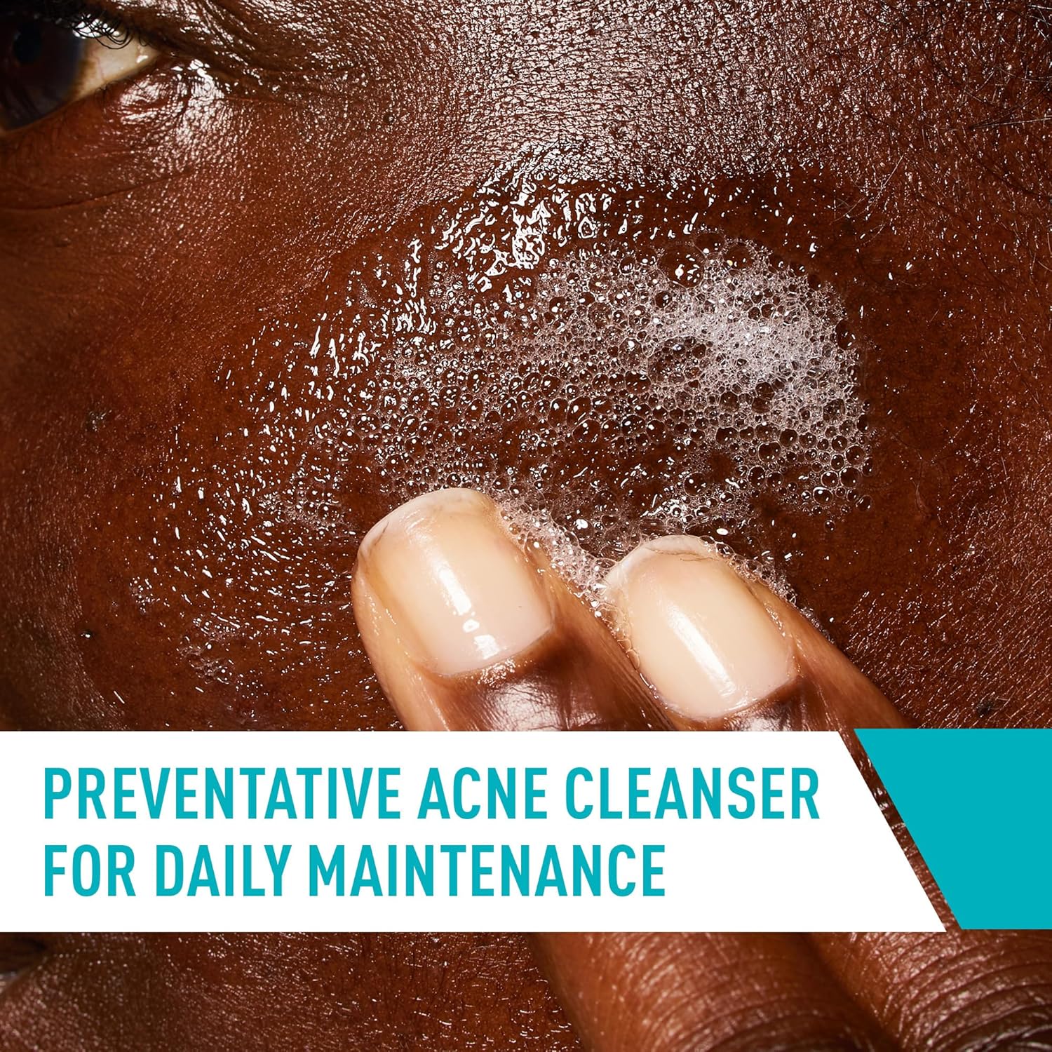 CeraVe Acne Control Cleanser. Face Wash with 2% Salicylic Acid. 16 oz | Skin Care with Niacinamide. Acne Face Wash. Acne Treatment For Face. Ceramides. Fragrance Free. Gentle. Oil Absorbing Clay