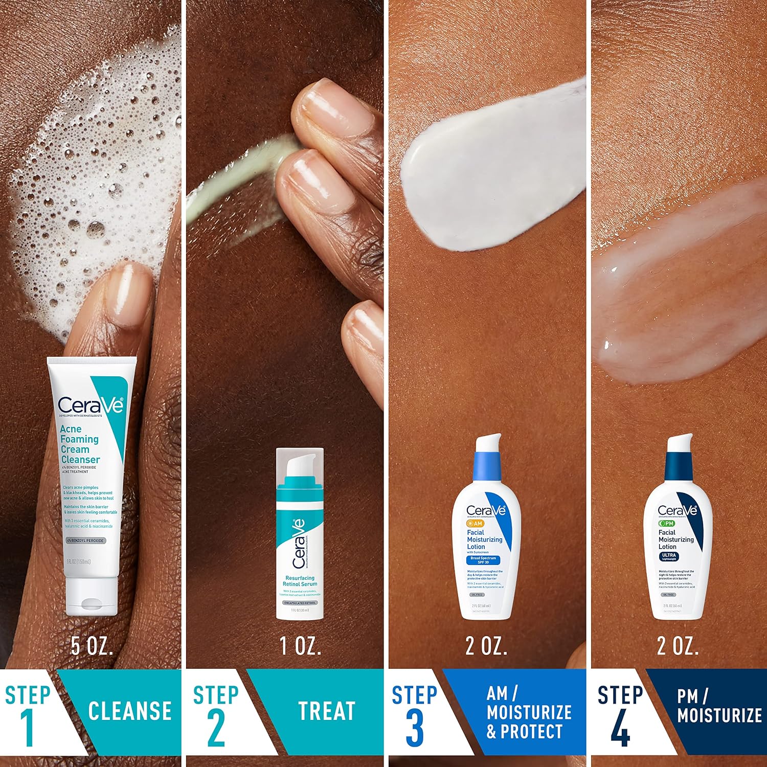 CeraVe Acne Skin Care Set. Foaming Cleanser + Retinol Serum + AM&PM Lotion | 5oz Acne Foaming Cream Cleanser + 1oz Resurfacing Retinol Serum + 2oz AM SPF 30 Lotion + 2oz PM Facial Moisturizing Lotion